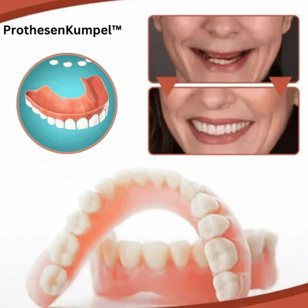 Snap on Veneers with Moldable Beads and Custom Fit False Teeth - Image 6